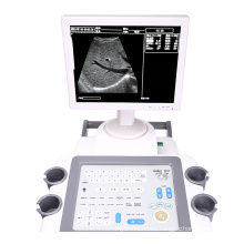 Color Bw Doppler Ultrasound Bluetooth Convex Linear Double Head Probes